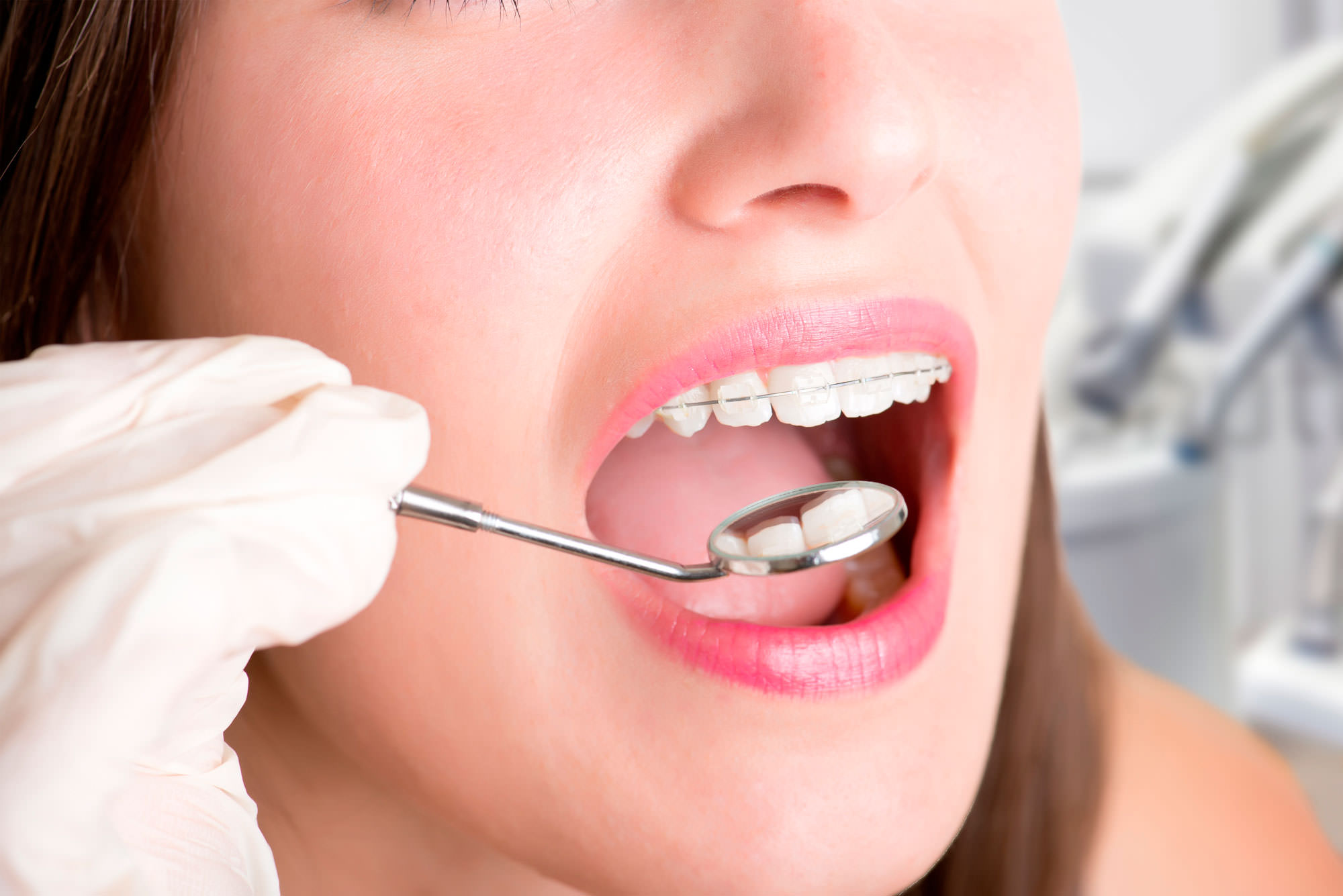 Ortodoncia en Granada | Dentista Dra. Cecilia Almagro